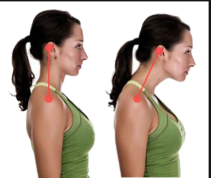 TOP 5 ejercicios para corregir la postura del cuello