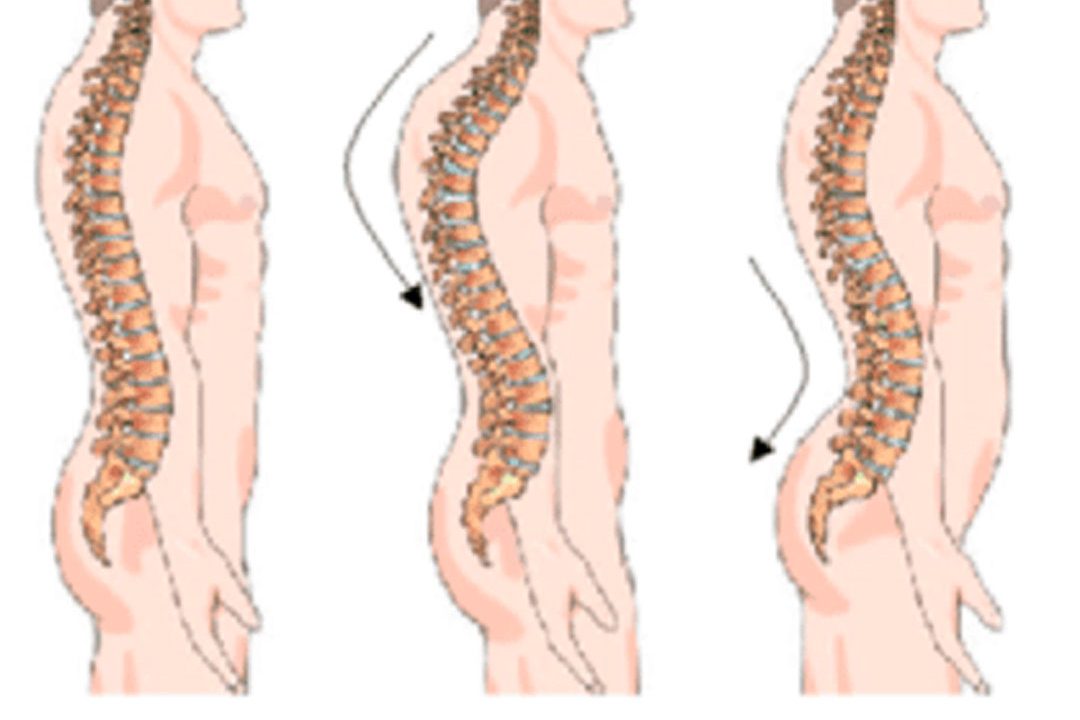 top 5 ejercicios para corregir postura de la espalda