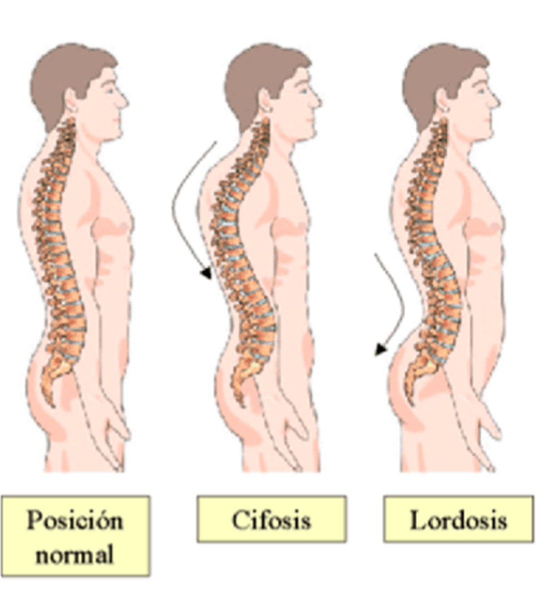 top 5 ejercicios para corregir postura de la espalda